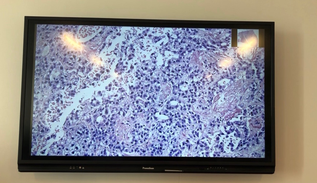 Zoom lame virtuelle. C.P : M.A